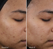Load image into Gallery viewer, Obagi Multi Acid Peel Pads